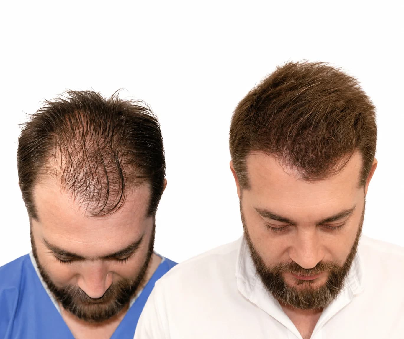 DHI restoration before and after
